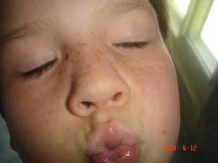 LukeyFace1